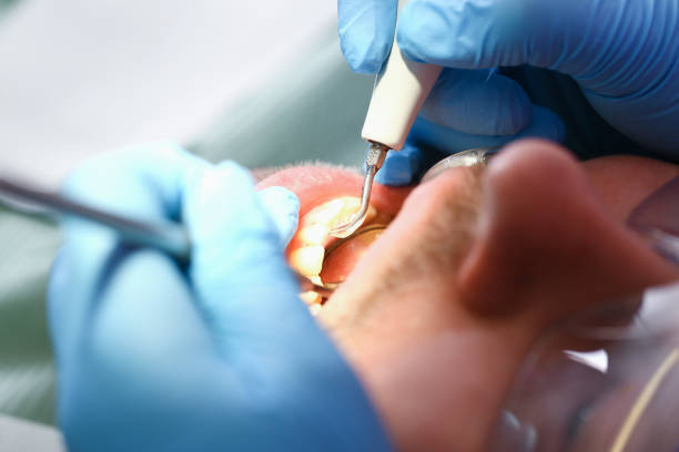 Best Chipped Tooth Repair Near Me  in , NJ