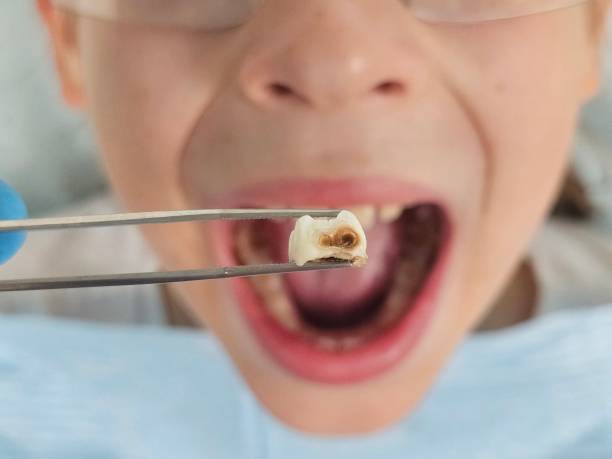 Best Cracked Tooth Emergency Dentist  in , NJ
